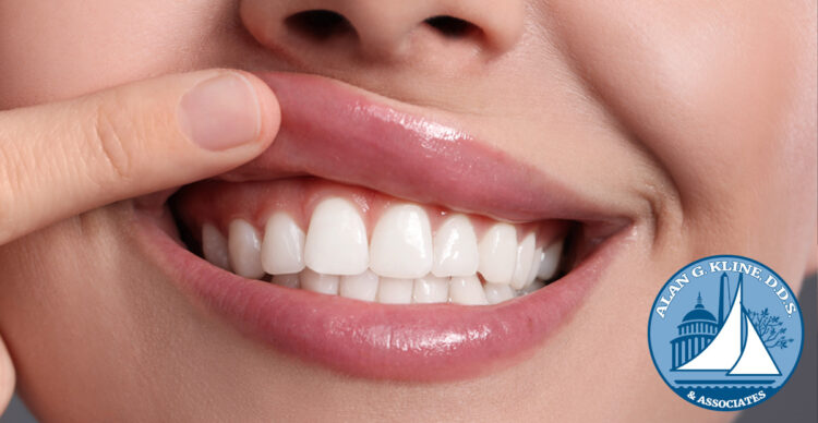 Receding Gums Causes and Cures